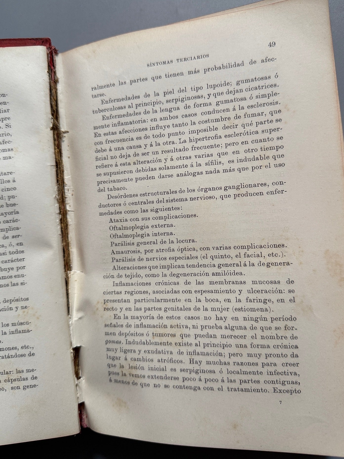 Libro de: La sífilis, Jonathas Hutchinson - Editorial de Ramón Molinas, 1888